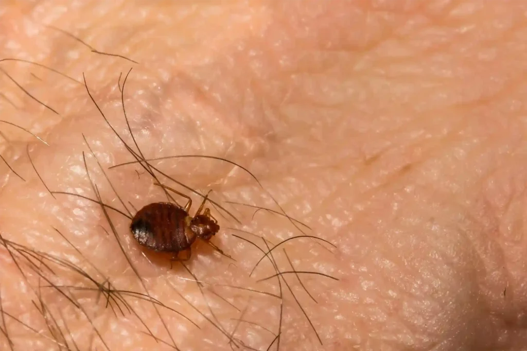 Bettwanzenbefall frühzeitig erkennen und Hautausschläge vermeiden – Kammerjäger Braunschweig